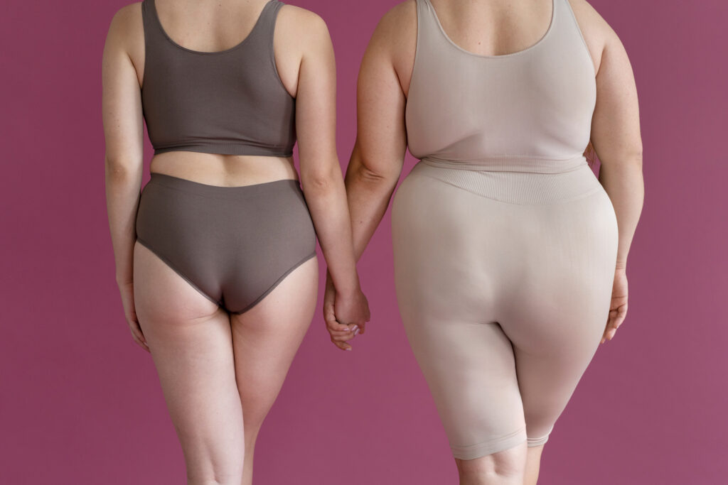 Before and After Weight Loss